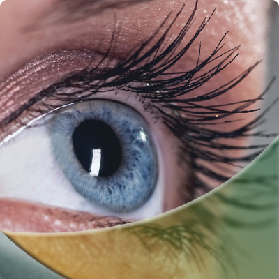 Eye Surgery in Dubai